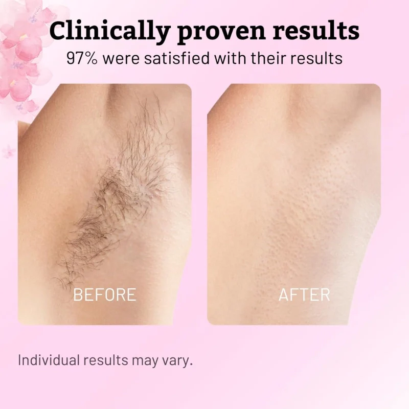 Recuvia™ Cyperus Rotundus Oil - Achieve Lasting Smoothness! - Image 5